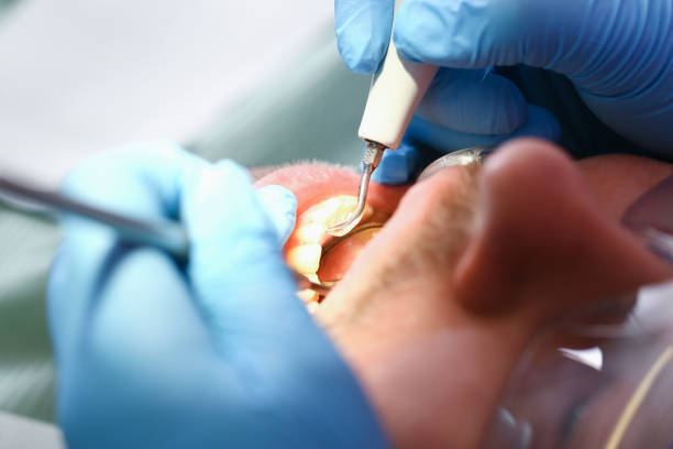 Best Emergency Dental Care for Sports Injuries in Tyndall Af, FL